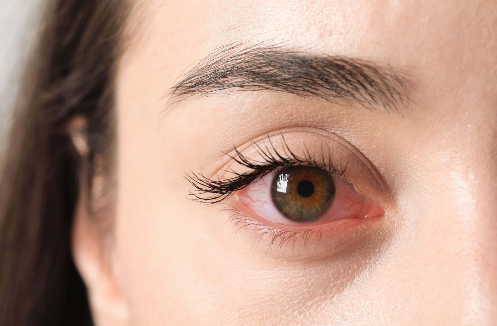 How to Unclog Meibomian Glands Naturally and Effectively